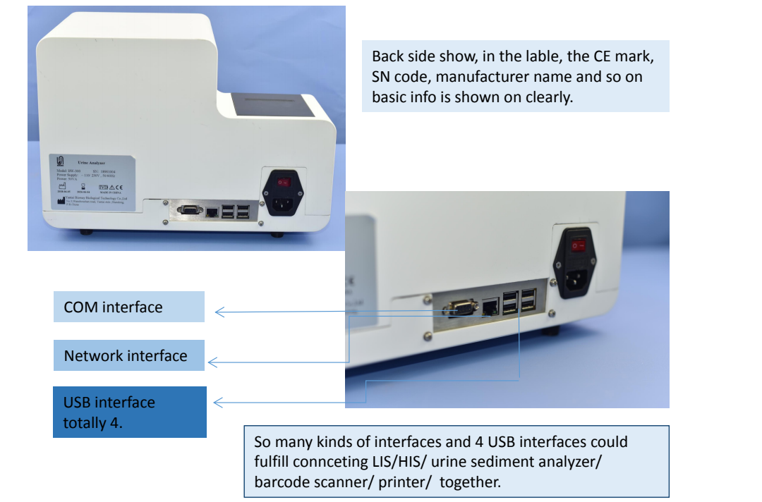 Features of semi automated urine chemistry