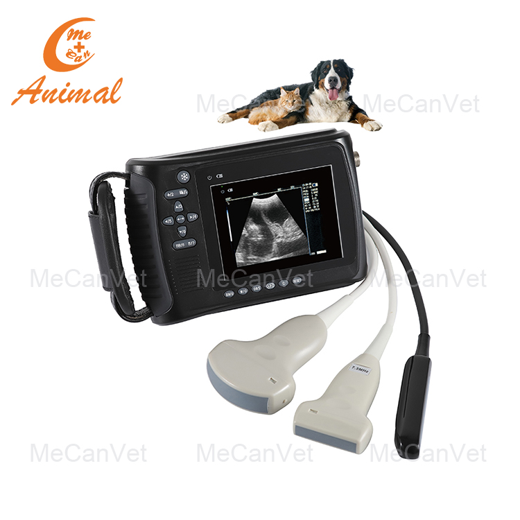 portable handheld ultrasound scanner