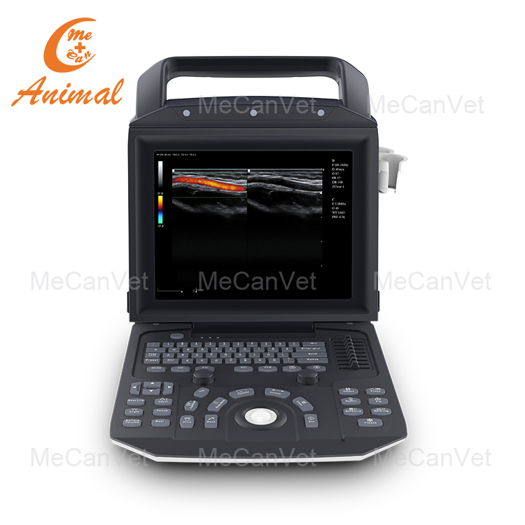 doppler color ultrasound scanner