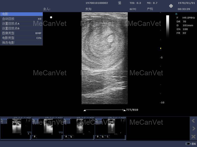Imaging Of Ultrasonic Diagnostic Scanner2
