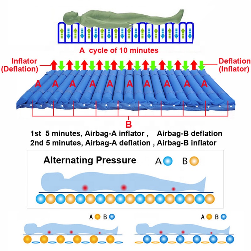 Bedsore Mattress