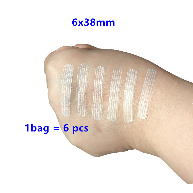 Wound skin closures