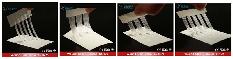 Wound skin closures