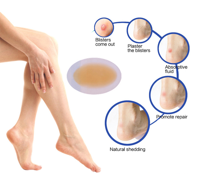 foot dressing