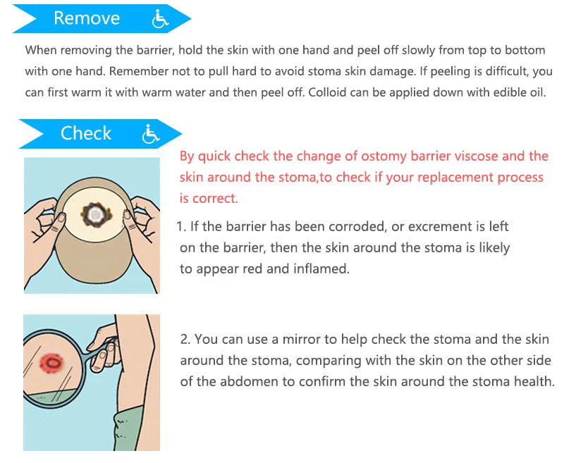 high quality colostomy bags