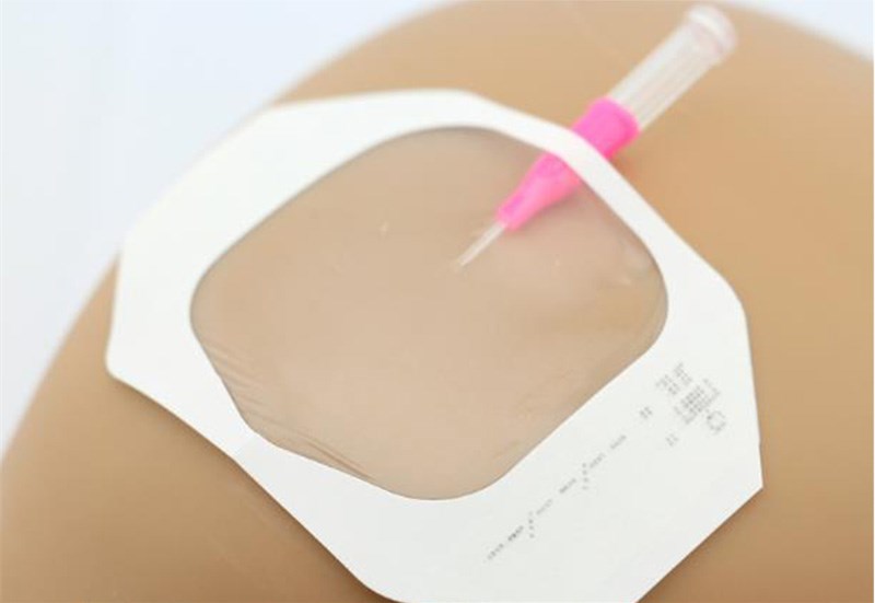 transparent dressing