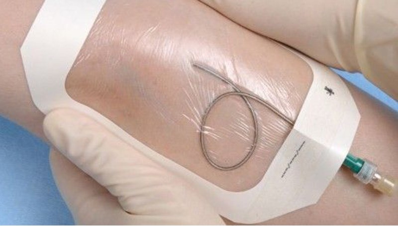 transparent dressing
