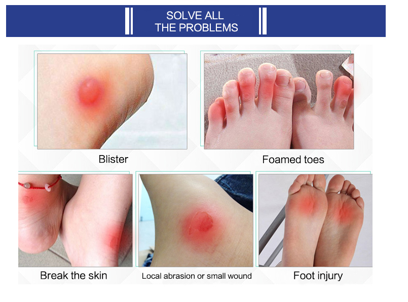 Hydrocolloid dressing.png