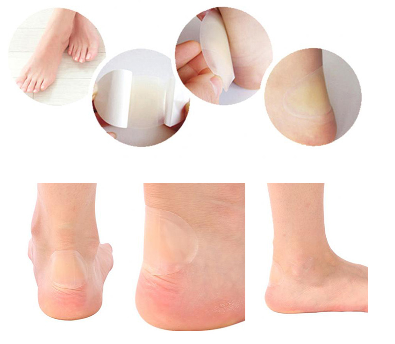 Hydrocolloid adhesive dressing.png