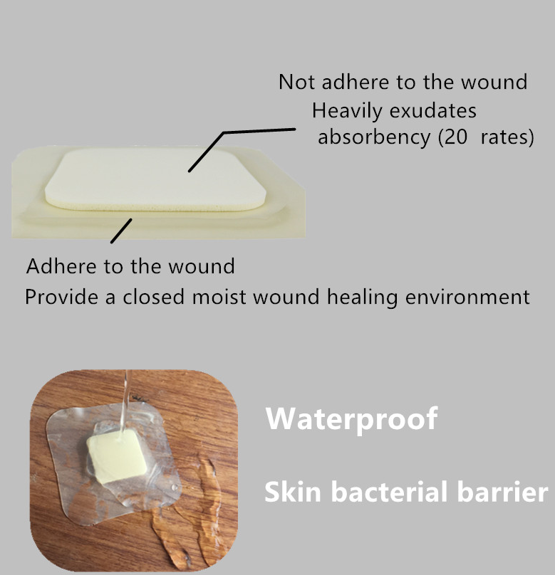 wound Foam dressing.png