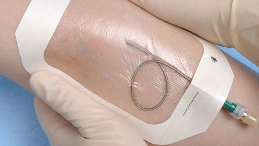 IV dressing.png