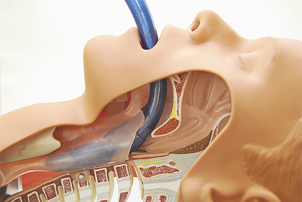 silicone laryngeal mask
