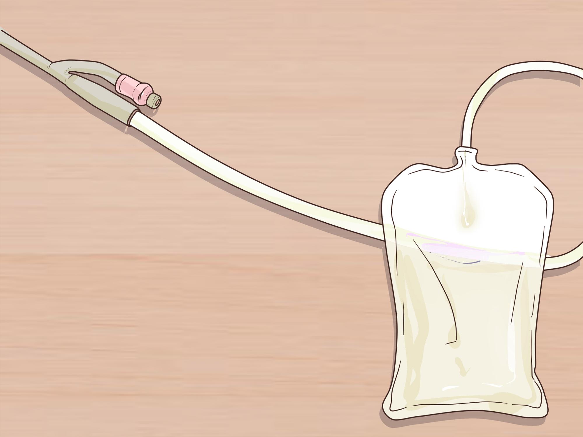 silicone foley catheter
