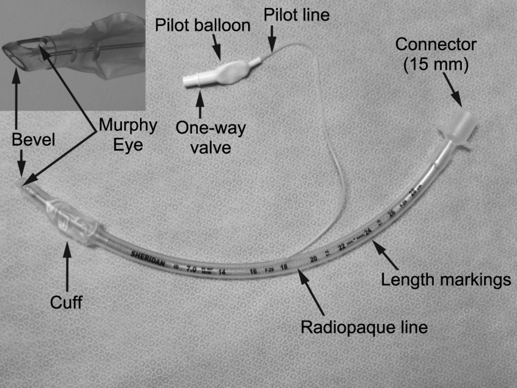 endotracheal tube