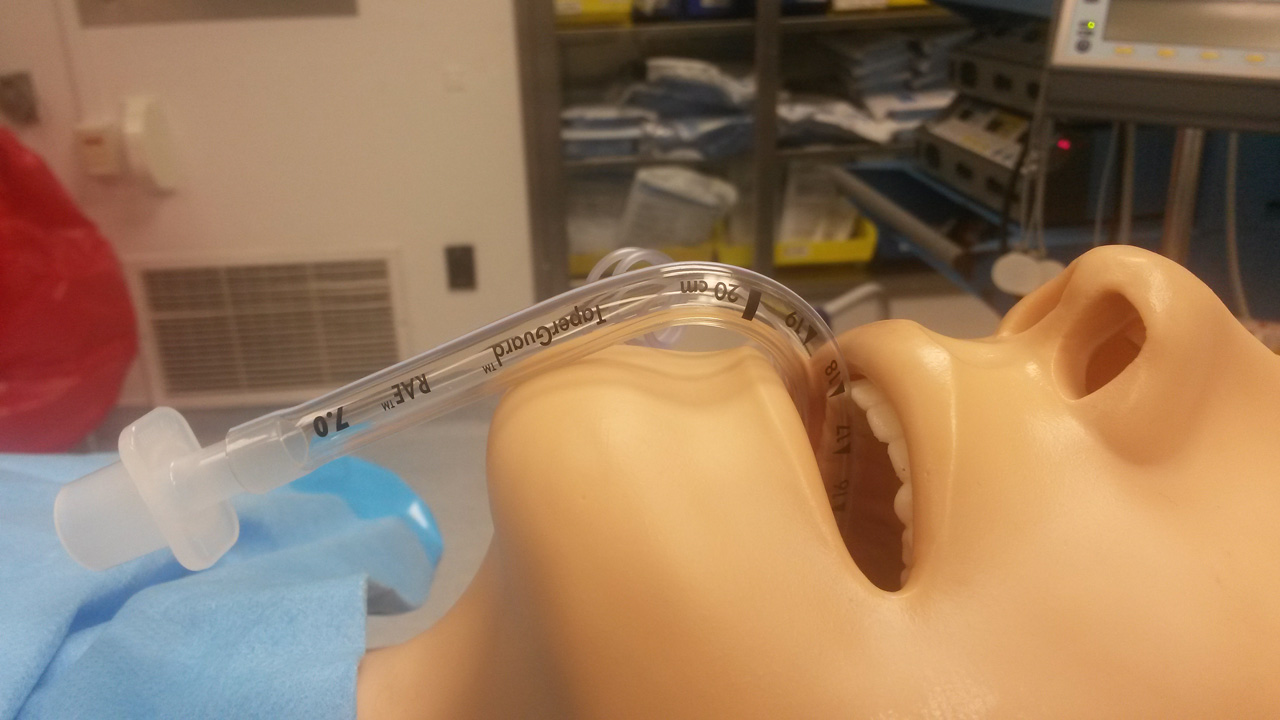 endotracheal tube