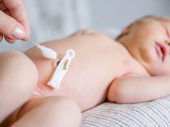 umbilical cord clamp