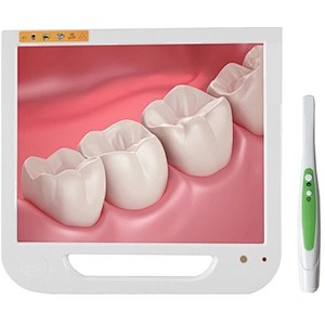 R02 Digital Dental intra Oral Camera with 17inch monitor(wifi)