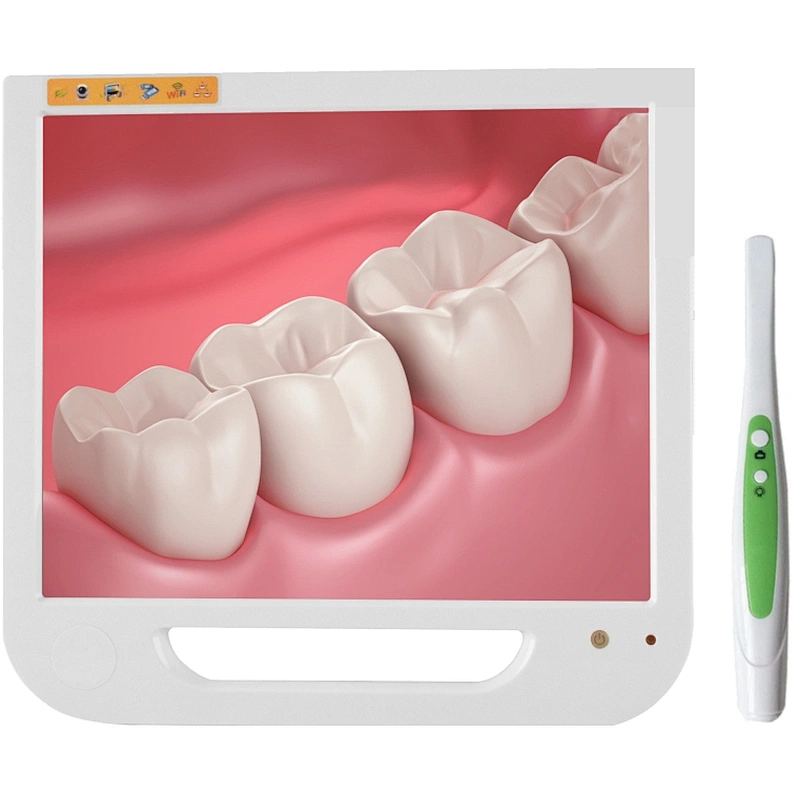 R02 Digital Dental intra Oral Camera with 17inch monitor(wifi)