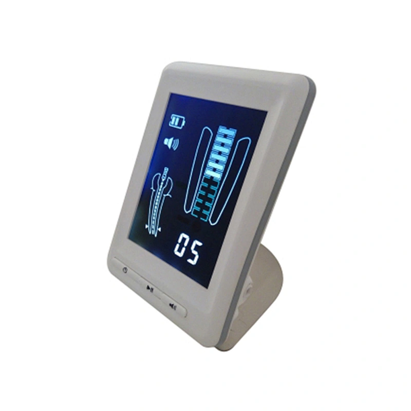 RT09 Apex loctaor