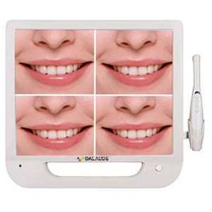 R04 Digital Dental intra Oral Camera with 17inch monitor(wifi)