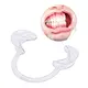 dental mouth cheek retractor