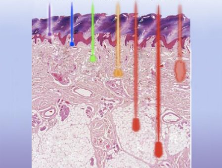 Penetration ability of different wavelengths