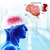 brain stimulation