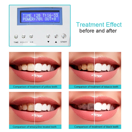 Led Mobile Portable Teeth Whitening Unit - 7