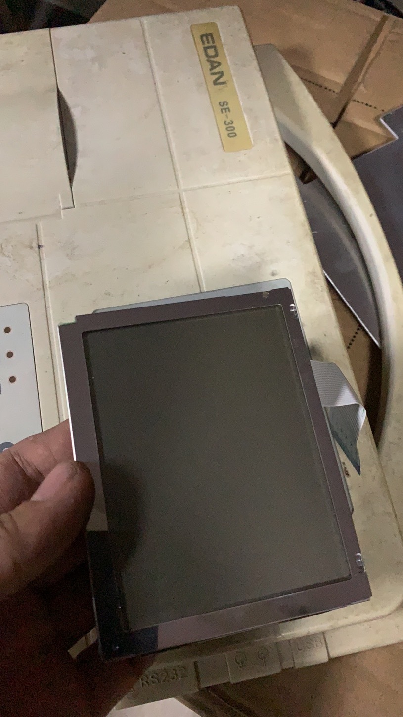 Pantalla de la máquina Edan SE-300 ECG