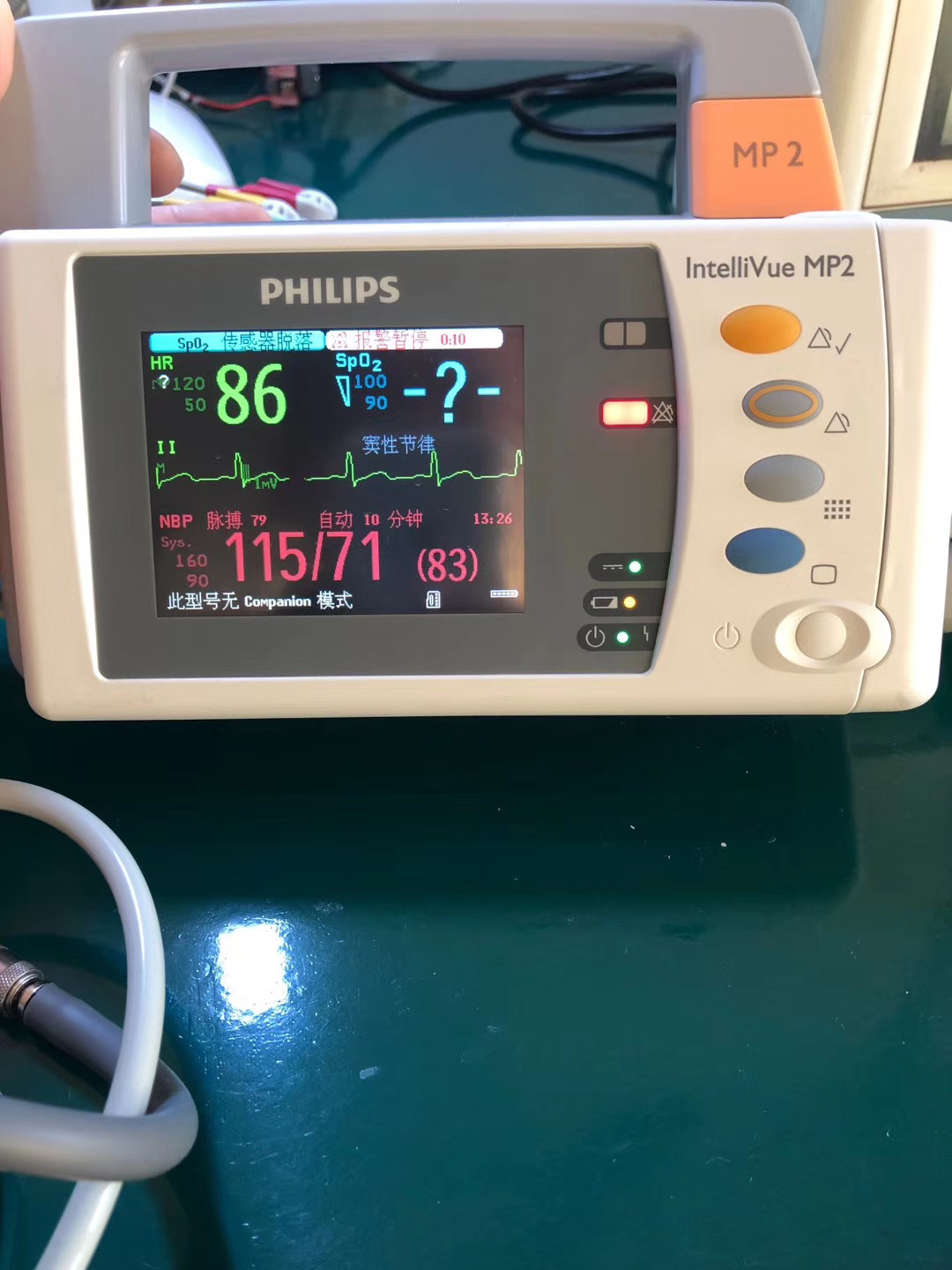 Reparación del módulo de monitor de paciente PHILIPS MP2