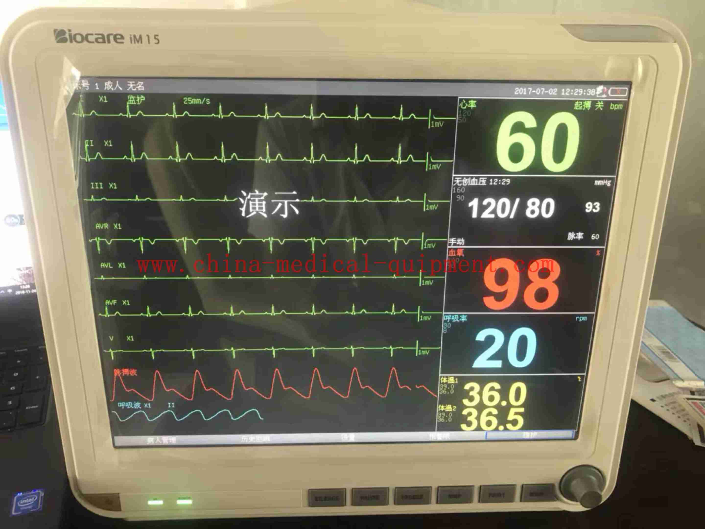 Monitor de paciente Biocare iM15