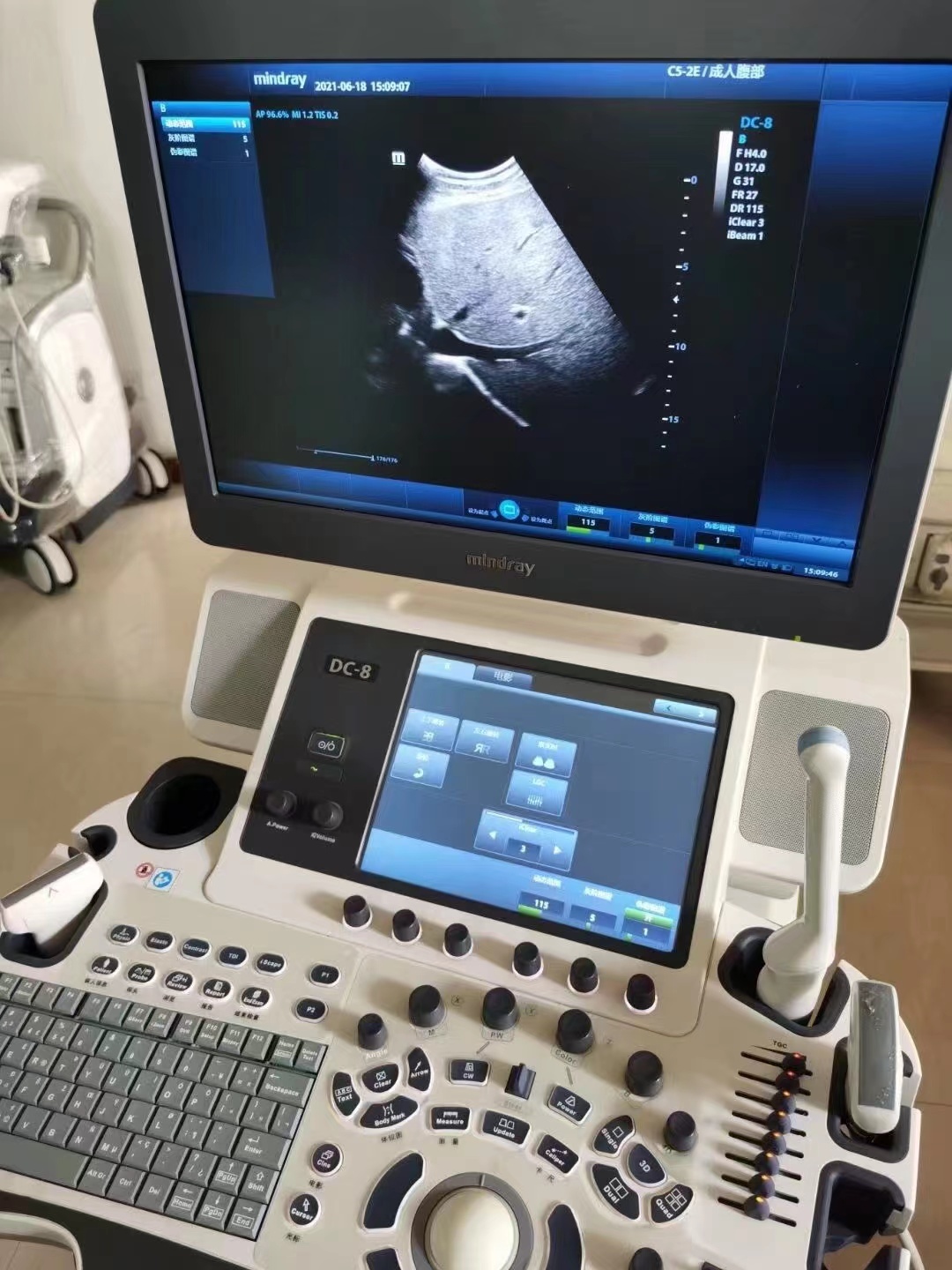 Mindray DC-8 Ultrasound machine
