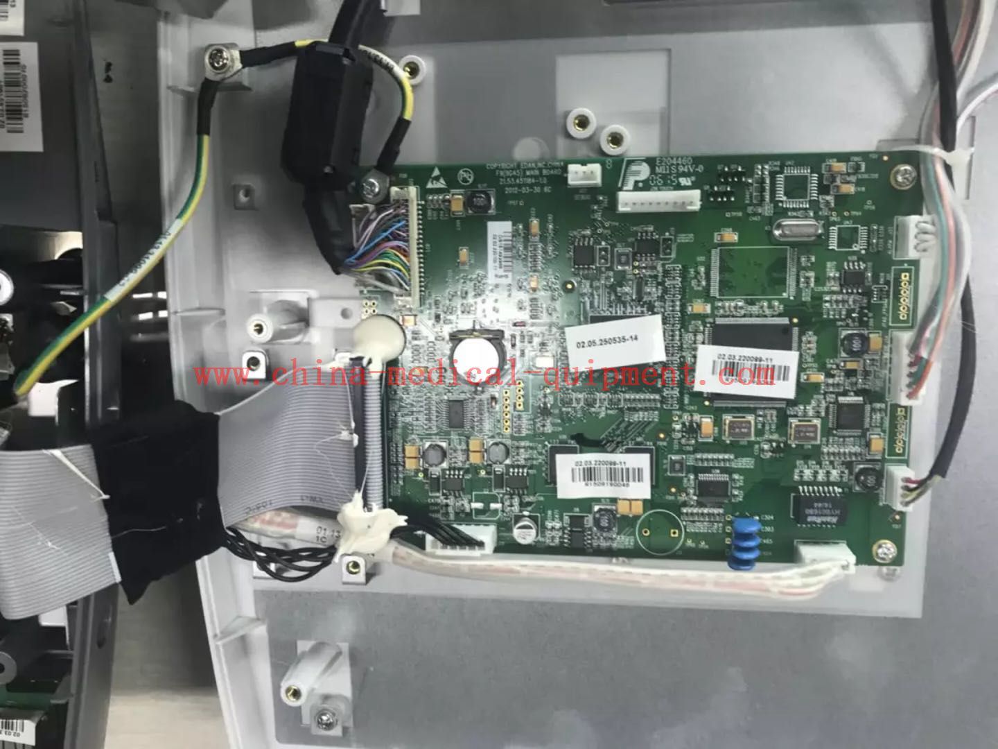 เมนบอร์ด/เครื่องพิมพ์/กระดานตรวจสอบทารกในครรภ์ EDAN F6