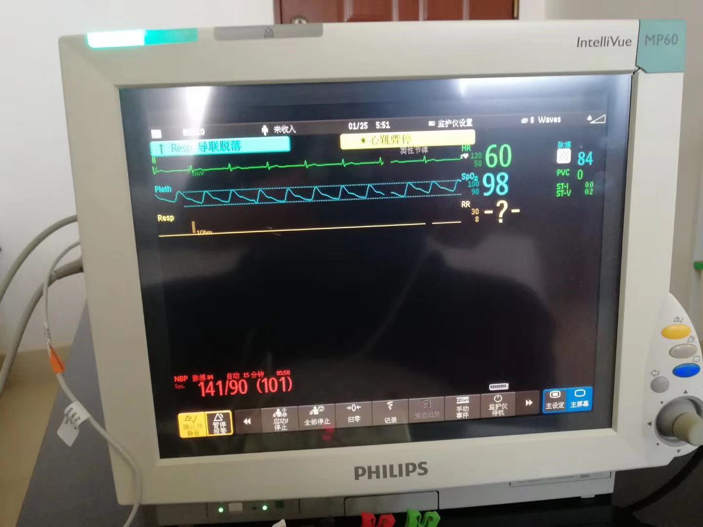 Pemantau pesakit PHILIPS MP60