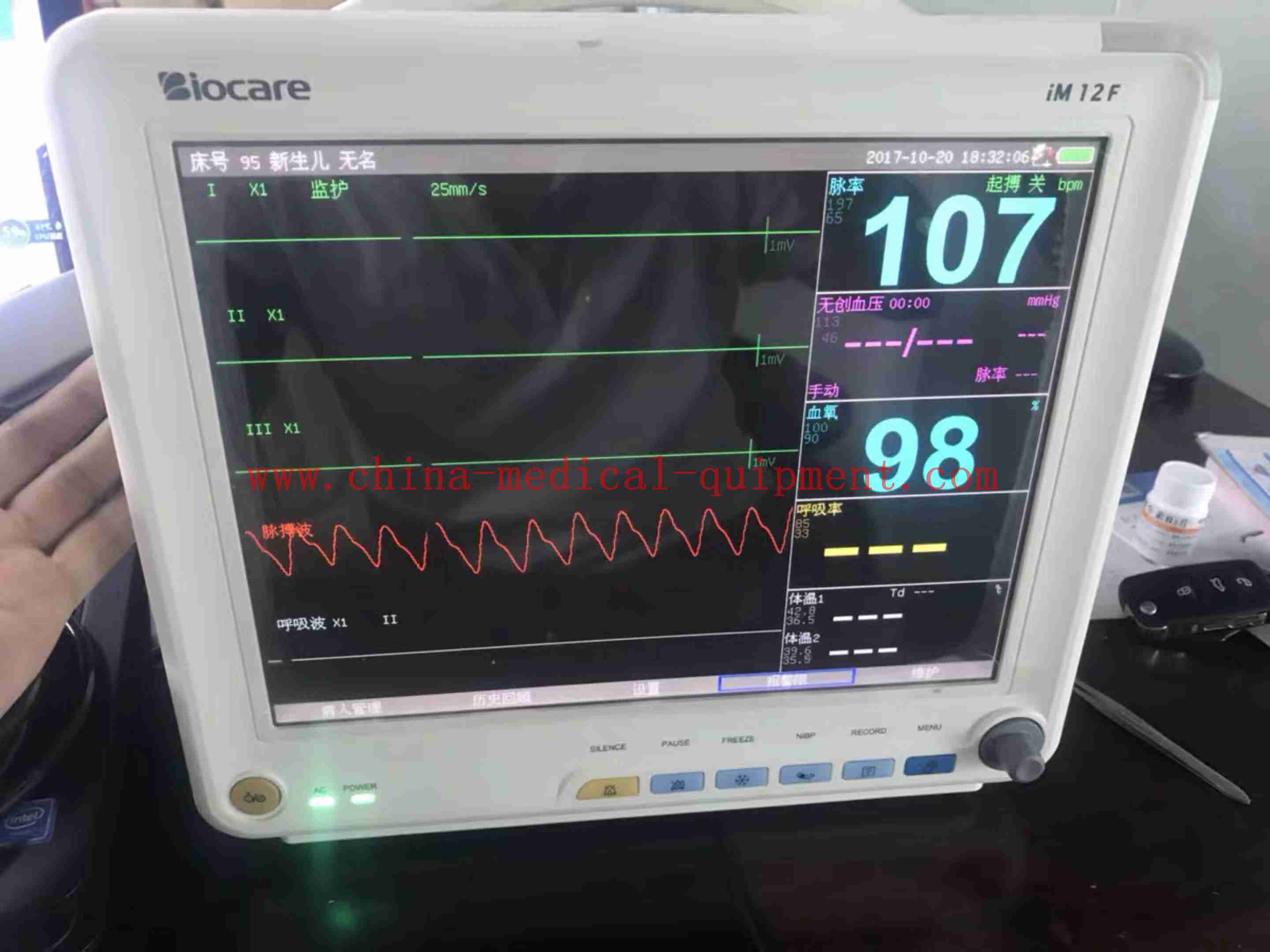 Monitor de paciente Biocare iM12F