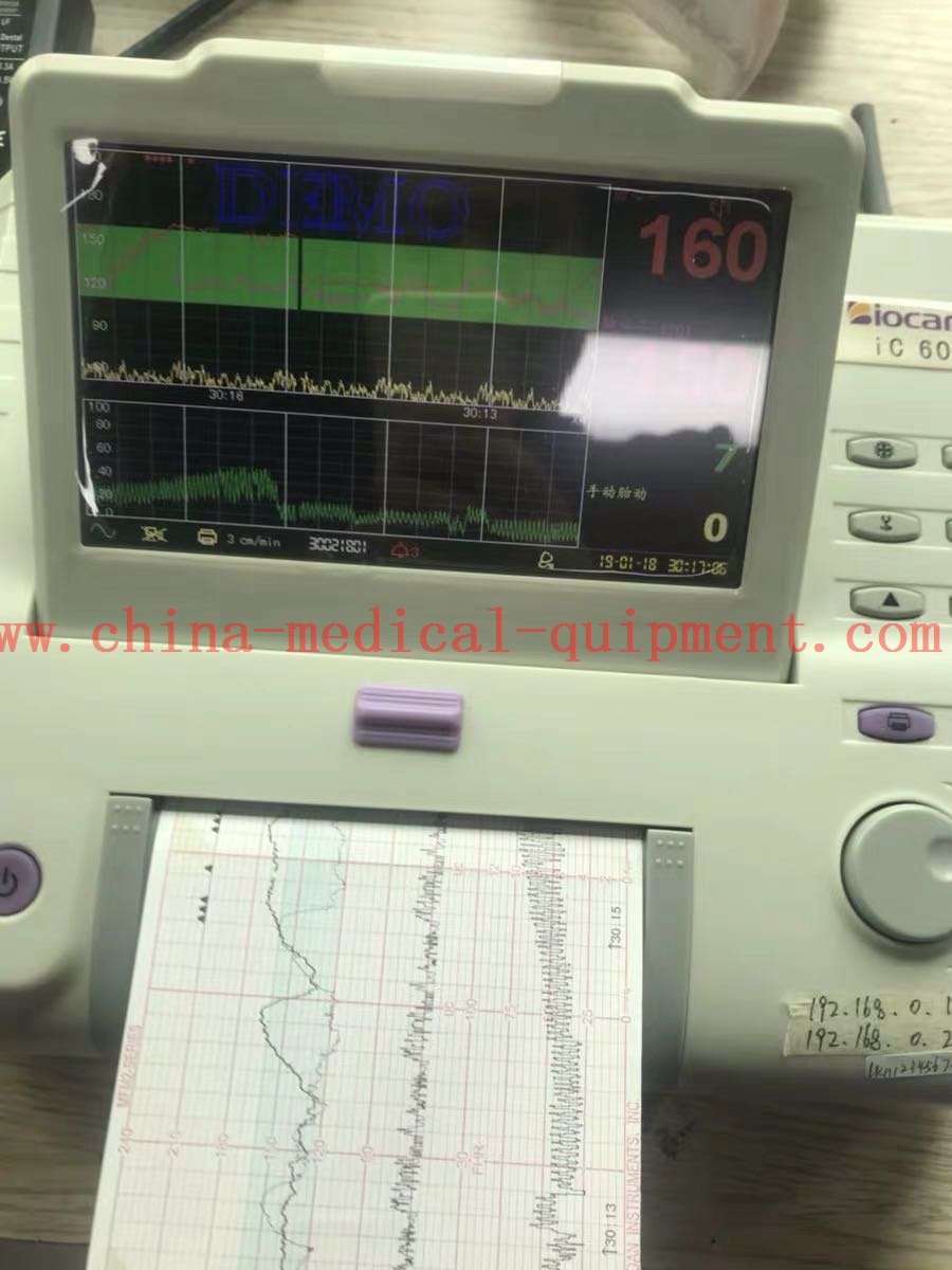 Papan utama/pencetak monitor janin Biocare ic60
