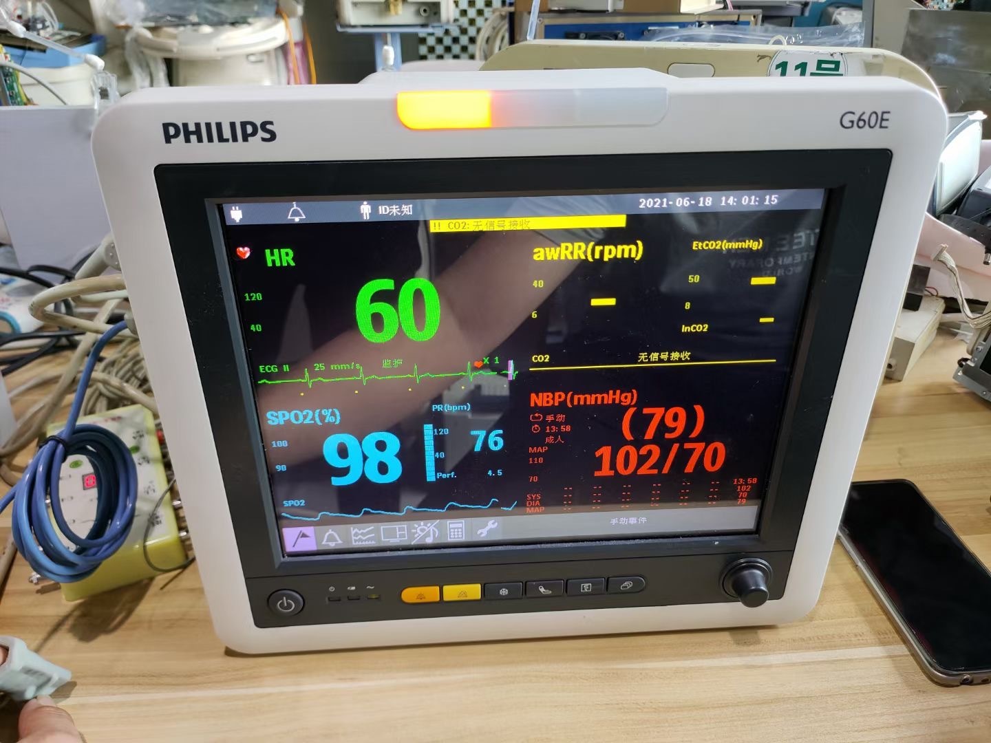 Pemantau pesakit PHILIPS G60E