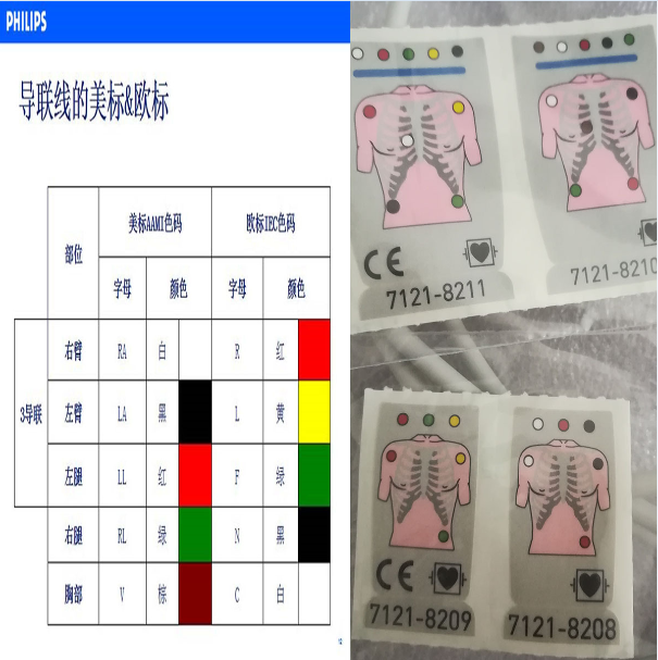 Differences between American and European standards for Philips ECG leads