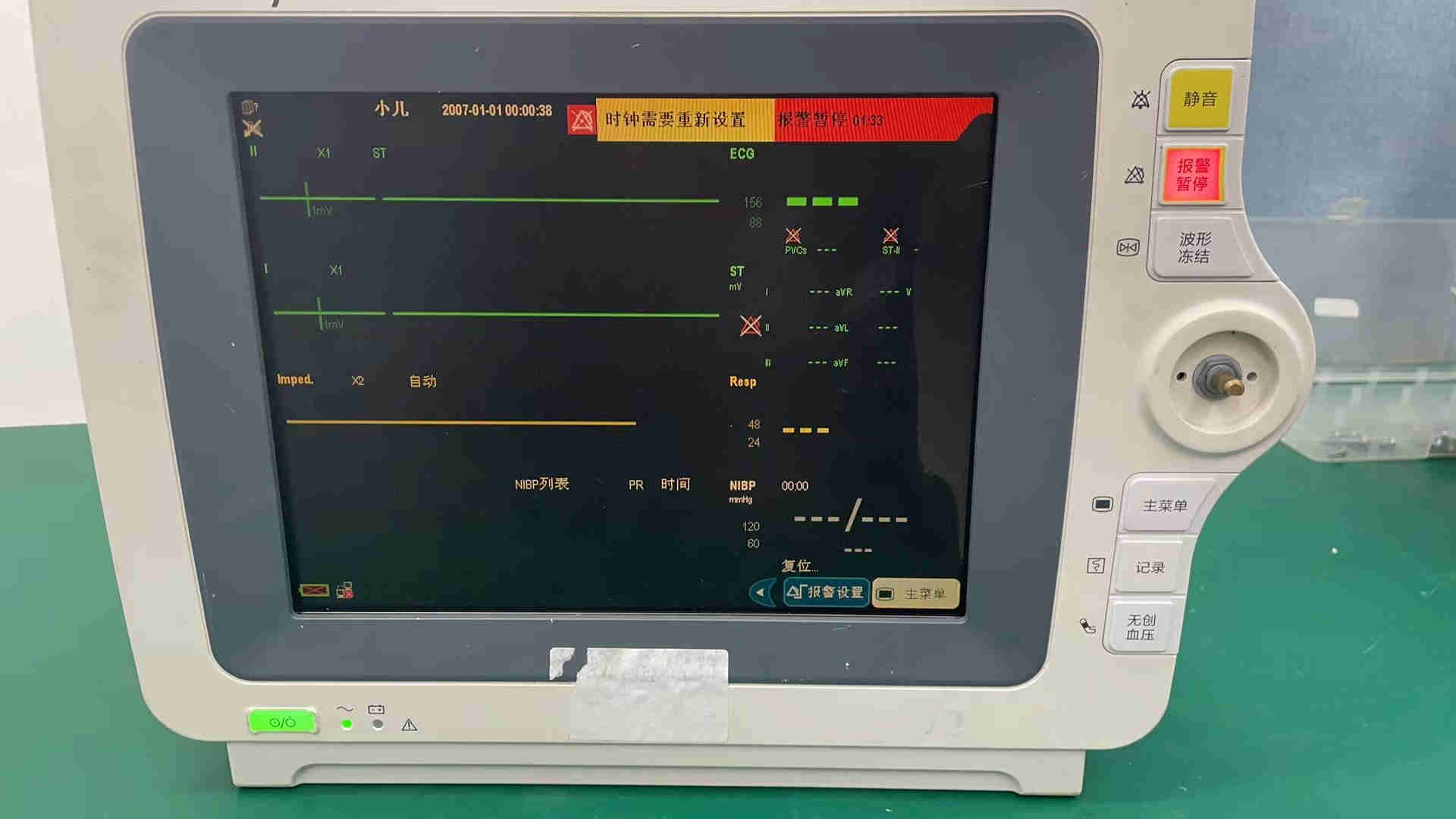 Monitor de paciente Mindray iMEC10