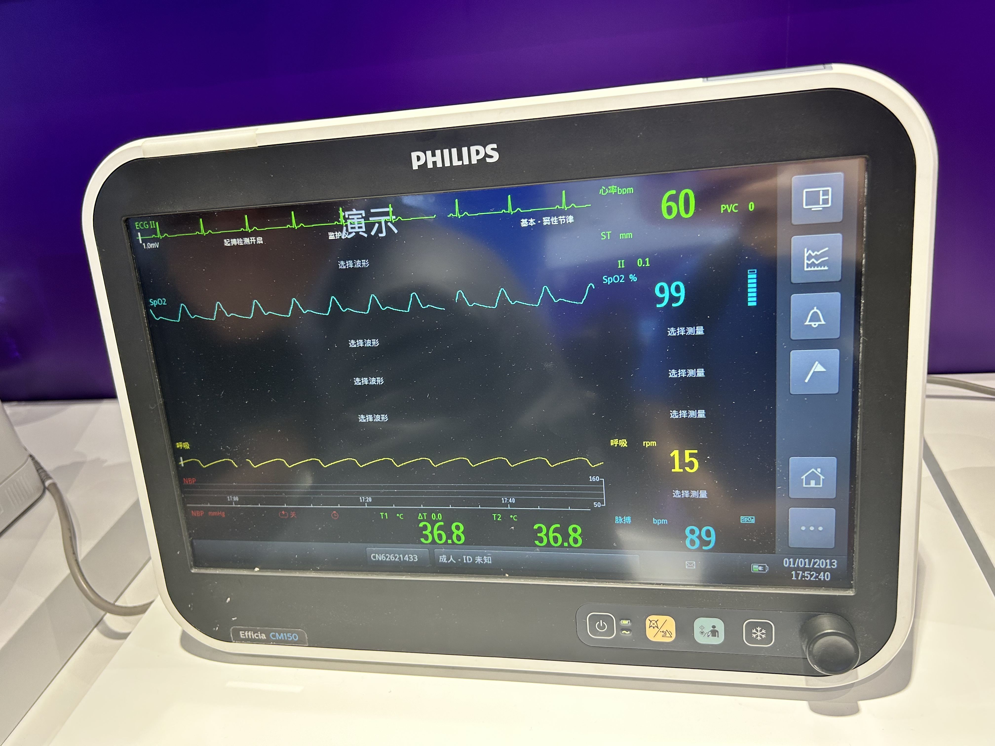 Philips Efficia CM150 Patient Monitor