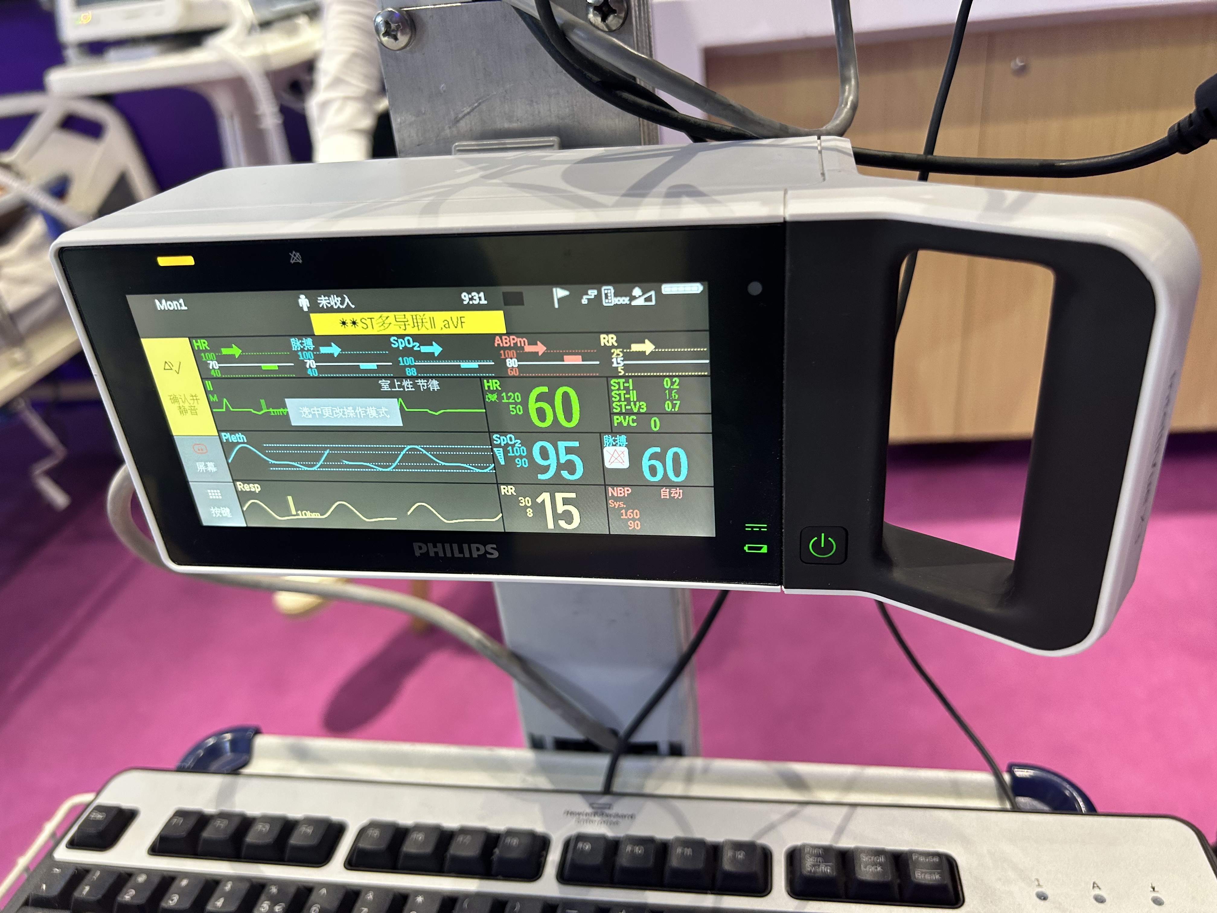 เครื่องตรวจสอบผู้ป่วย Philips IntelliVue X3