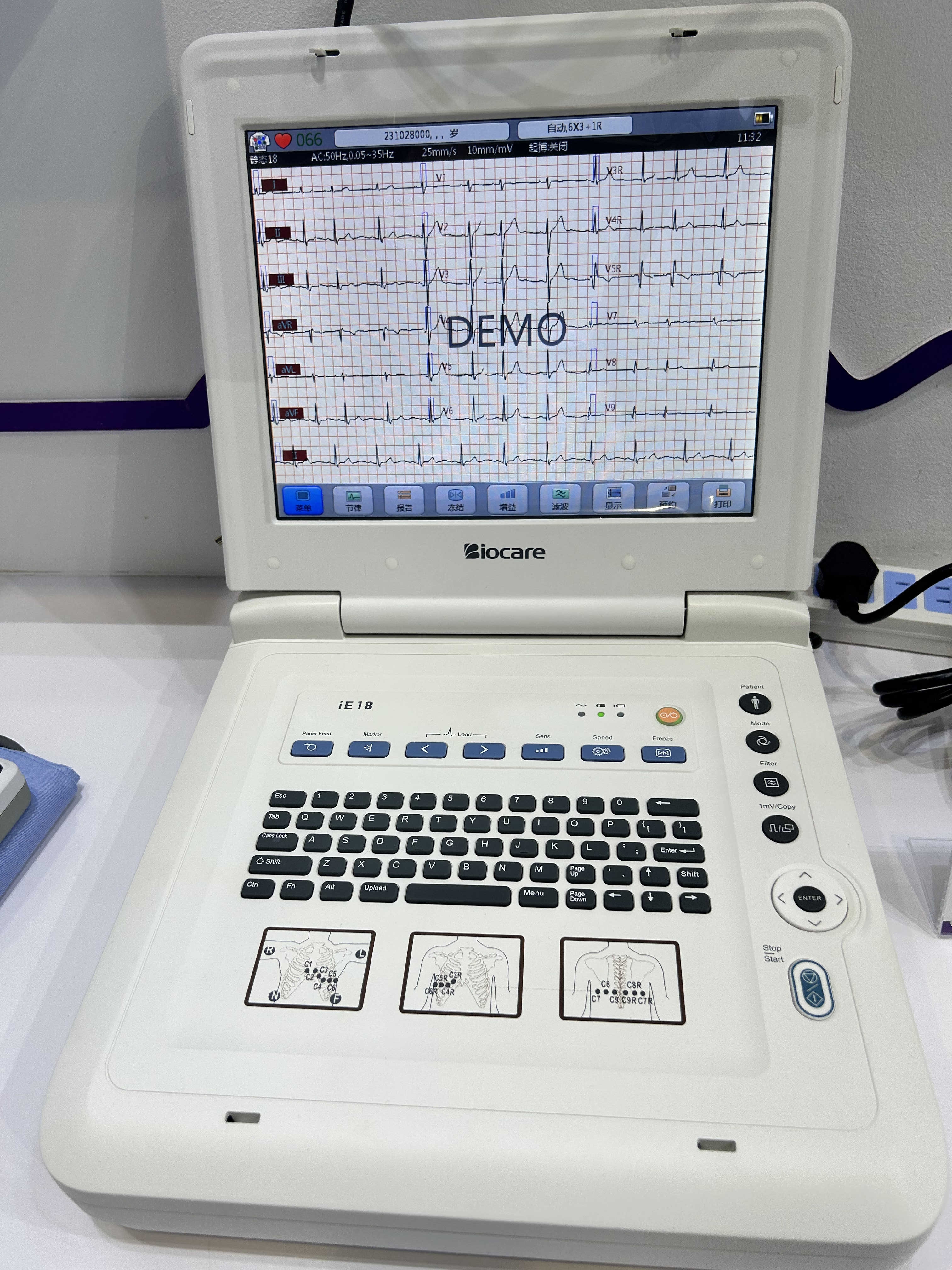 Mesin ECG BIOCARE IE18 Untuk Pembaikan