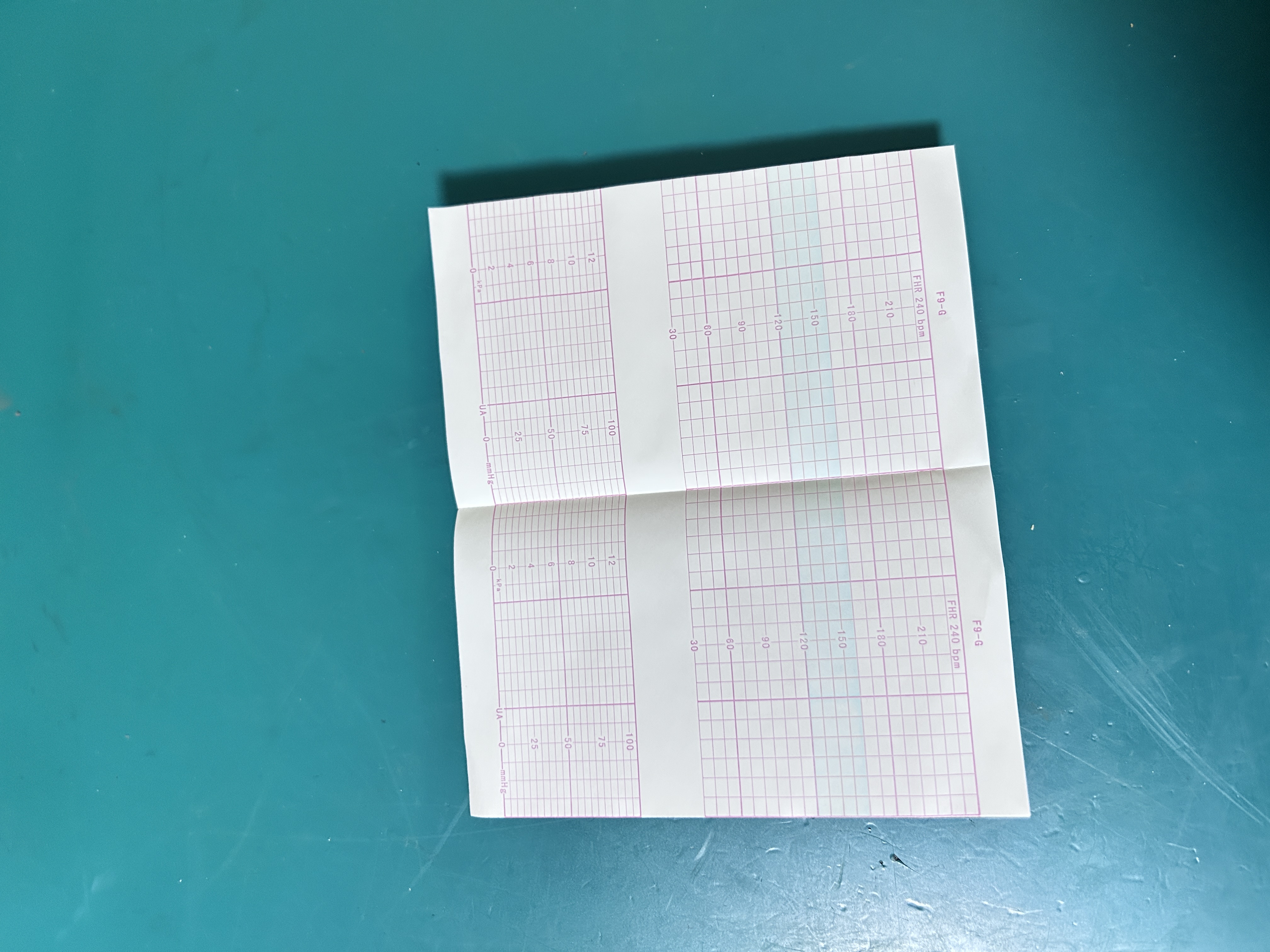 EDAN F200 F300 fetal monitor printing paper 9cm x 15cm