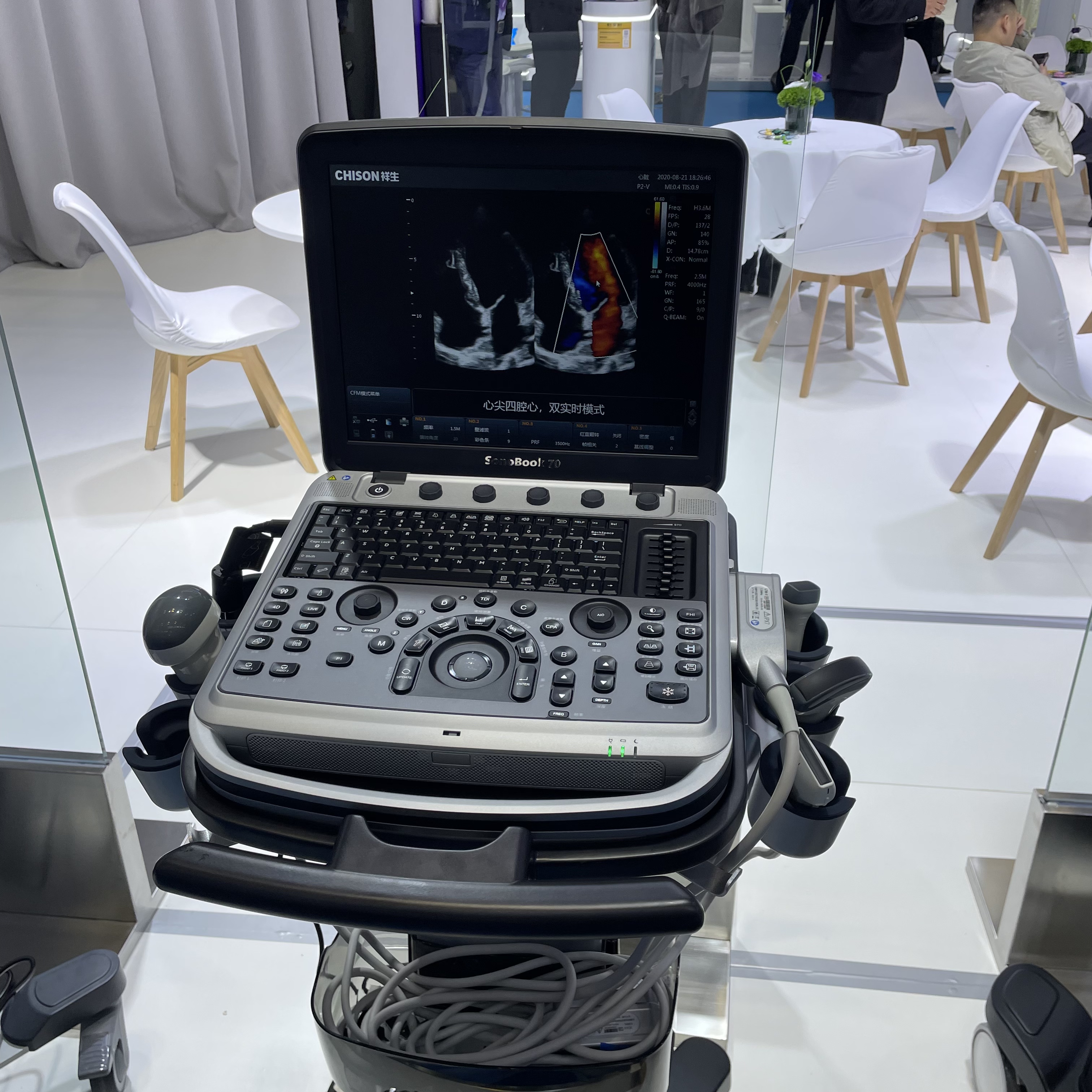 Ultrasonido Doppler color Chison Sonobook 70