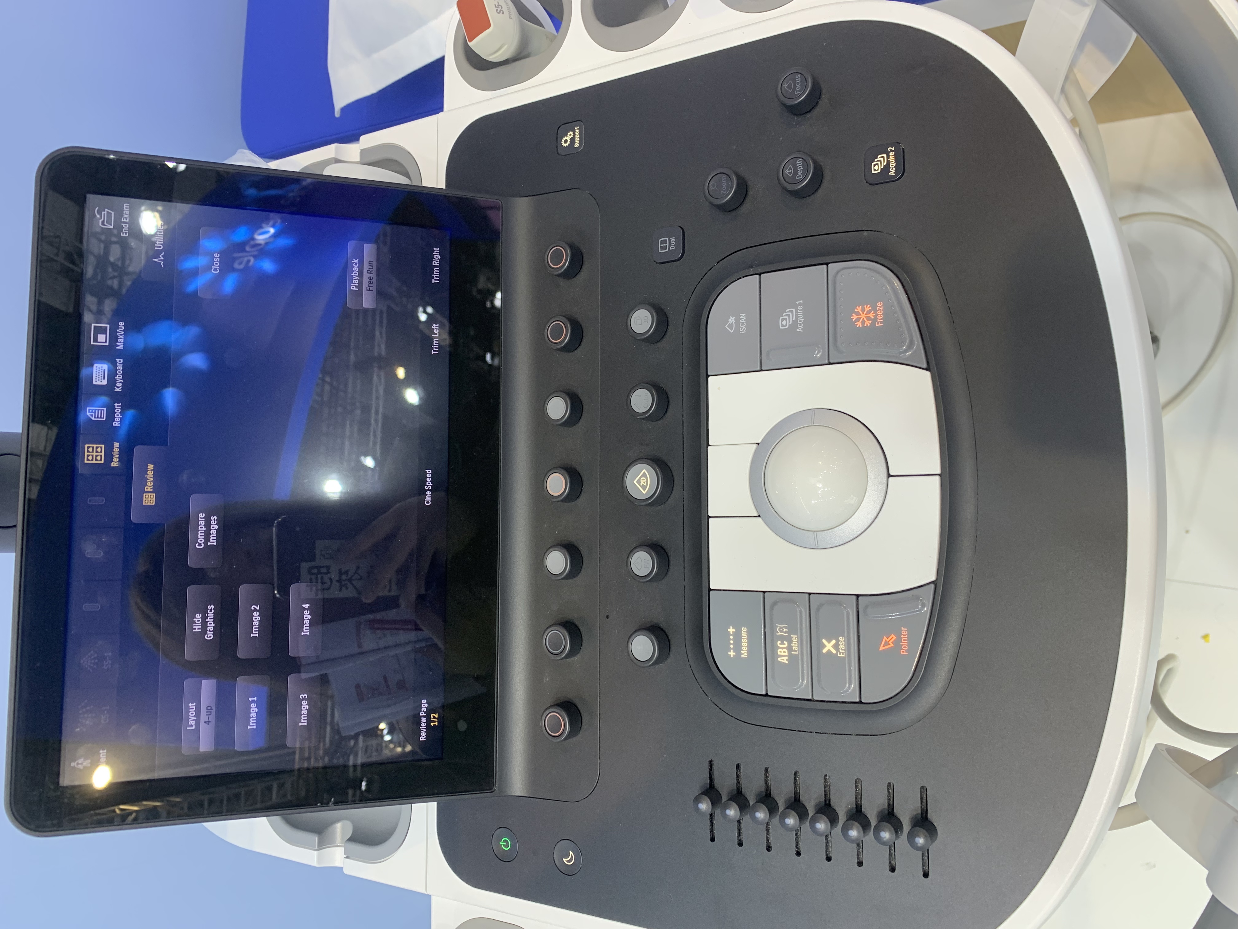 Philips EPIQ Elite Elevate Ultrasound System untuk Obstetrik dan Ginekologi