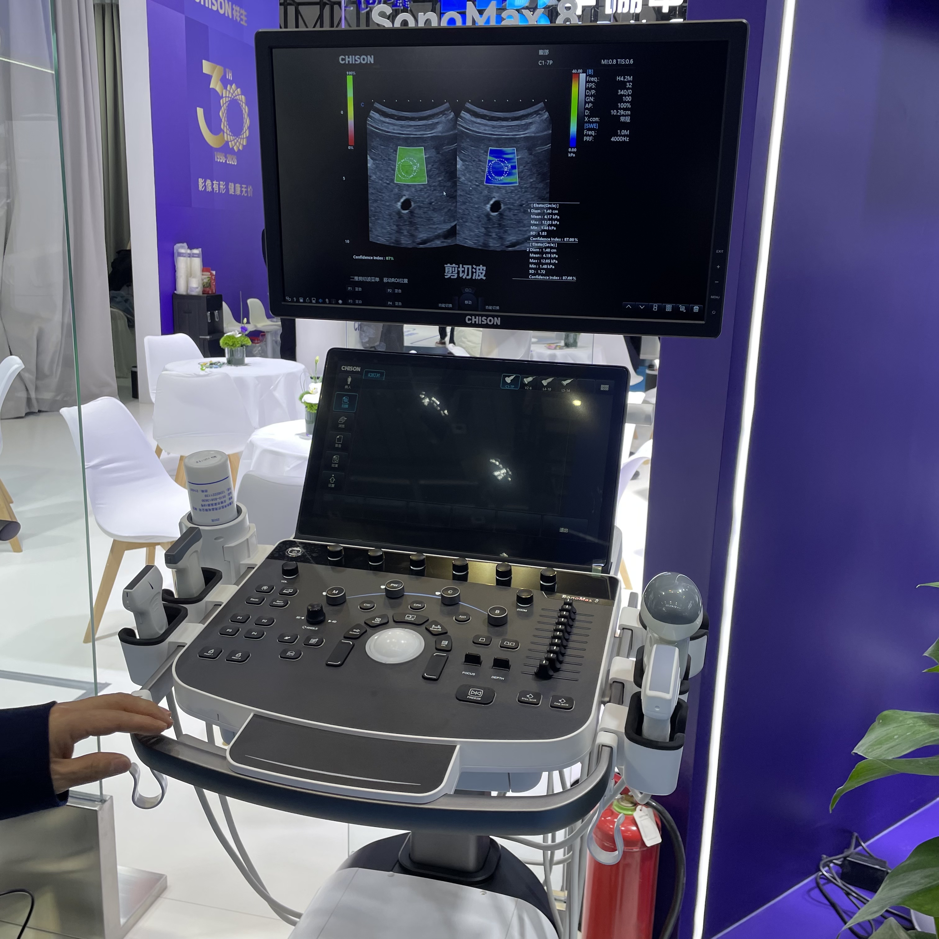 CHISON SonoMax 8 Mid- to High-End Desktop Color Doppler Ultrasound
