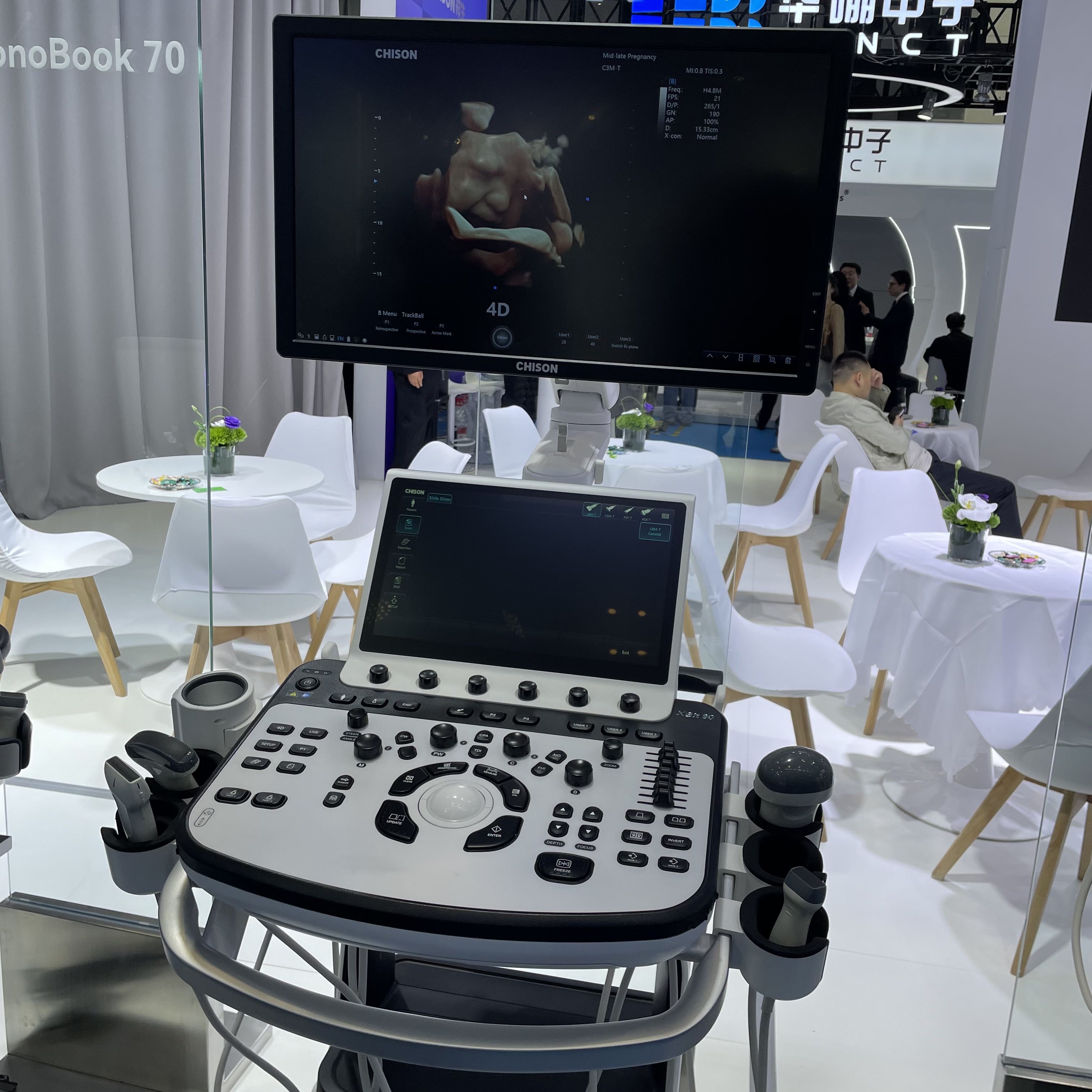 CHISON XBit 90 Color Doppler Ultrasound
