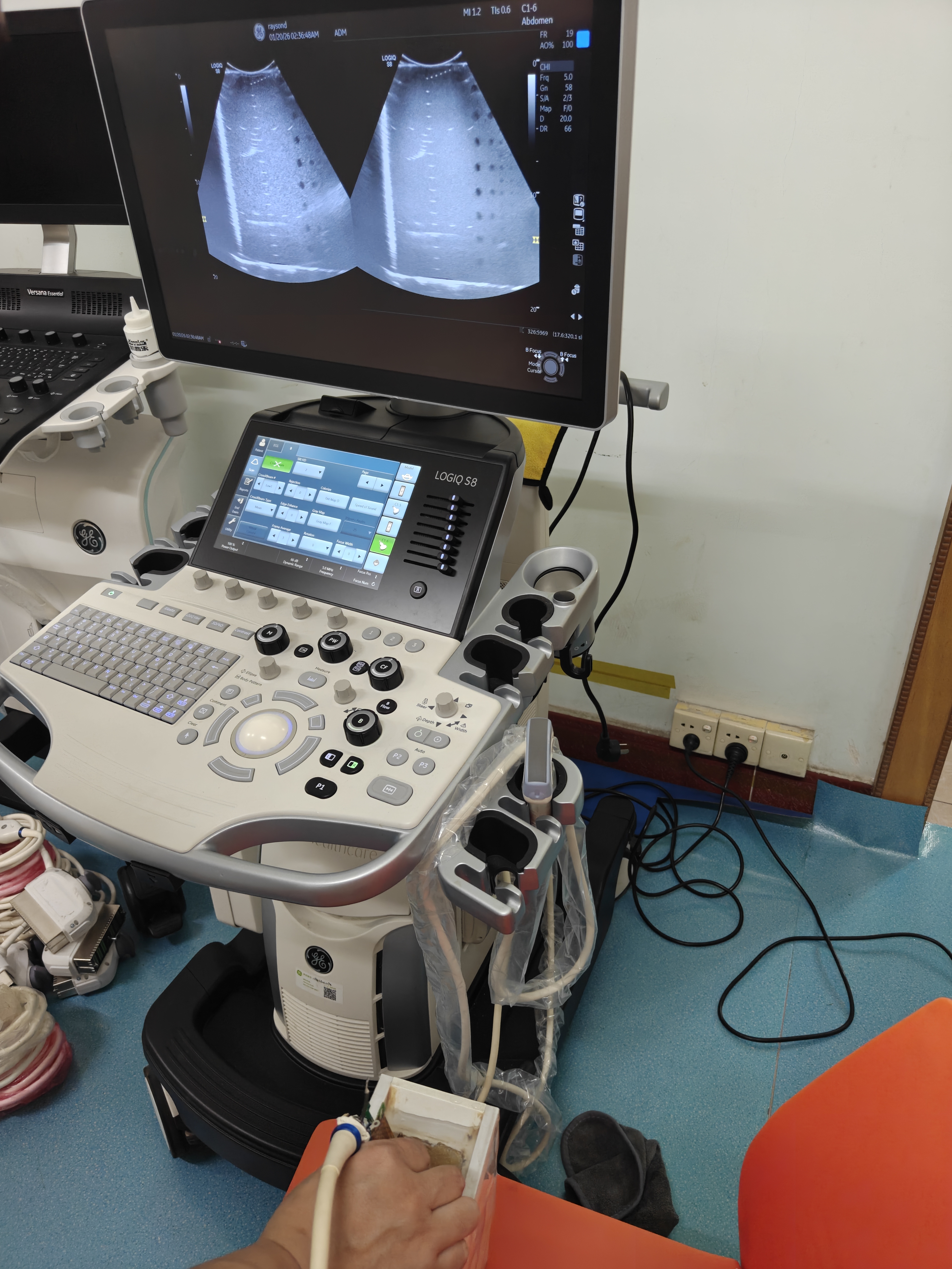 GE LOGIQS8 Ultrasonic Diagnostic System