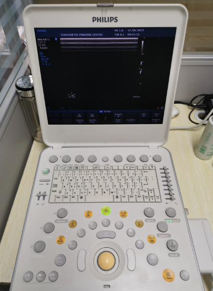 Philips CX50 portable color Doppler ultrasound
