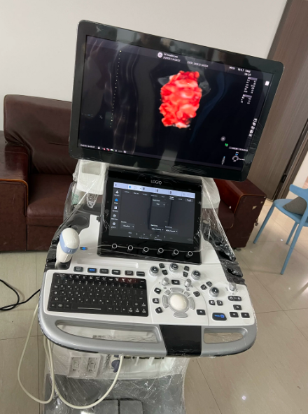 GE ultra-high-definition four-dimensional ultrasound machine LOGIQ E11, a full-body machine equipped with a high-end four-dimensional color Doppler ultrasound system